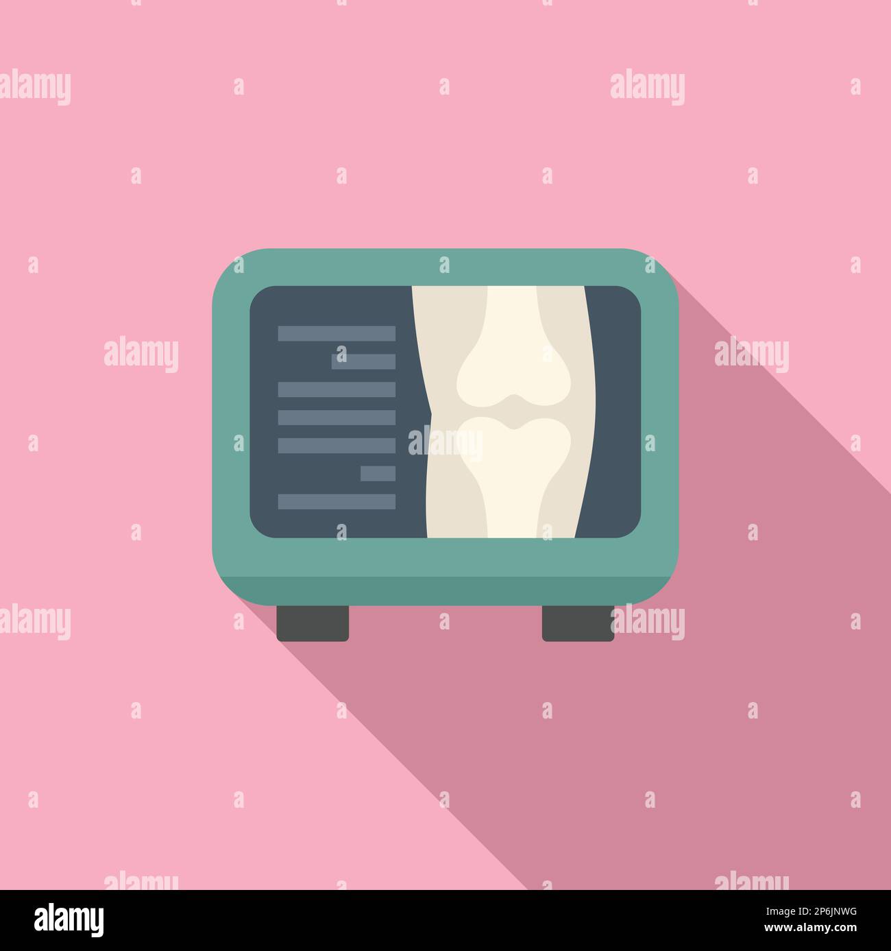 Osteoporosis xray Stock Vector Images Alamy