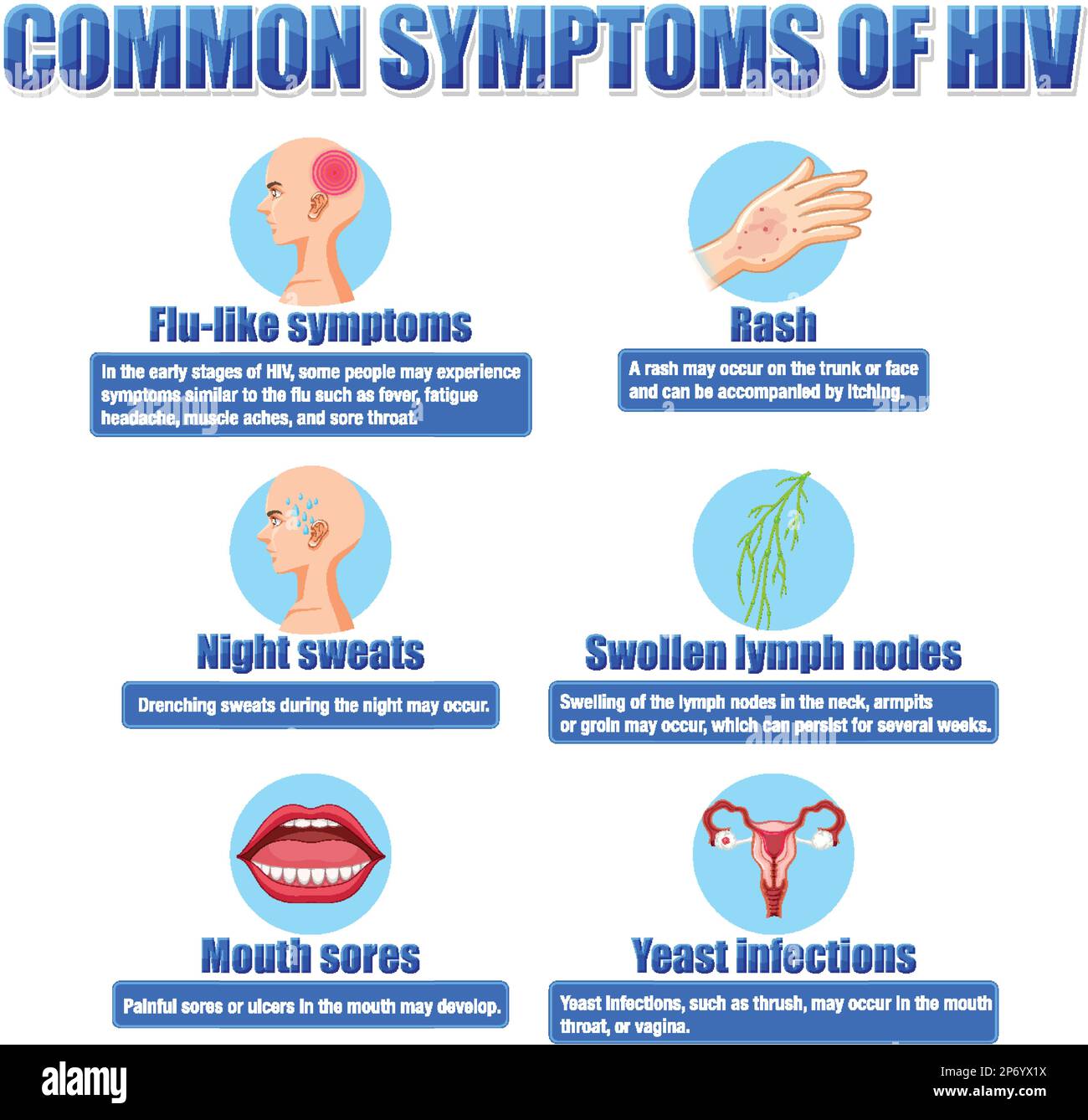 Informative poster of common symptoms of HIV illustration Stock Vector ...