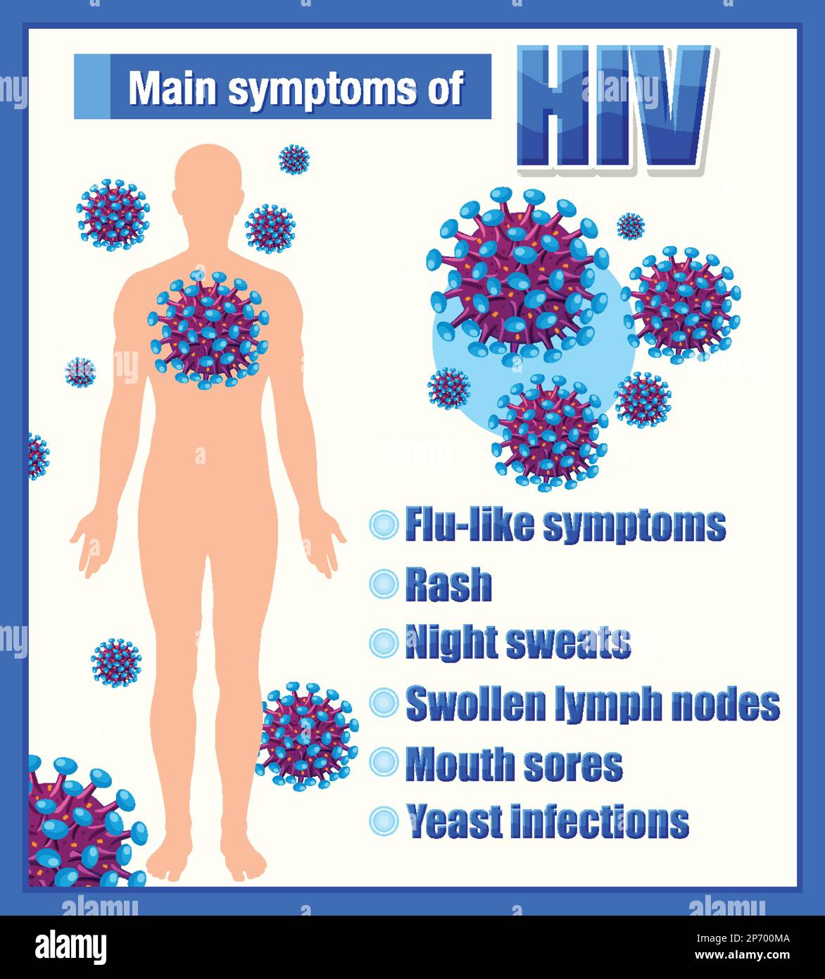 Informative poster of main symptoms of HIV illustration Stock Vector ...