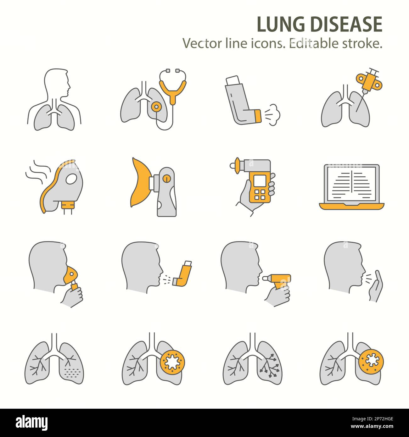 bronchial-pneumonia