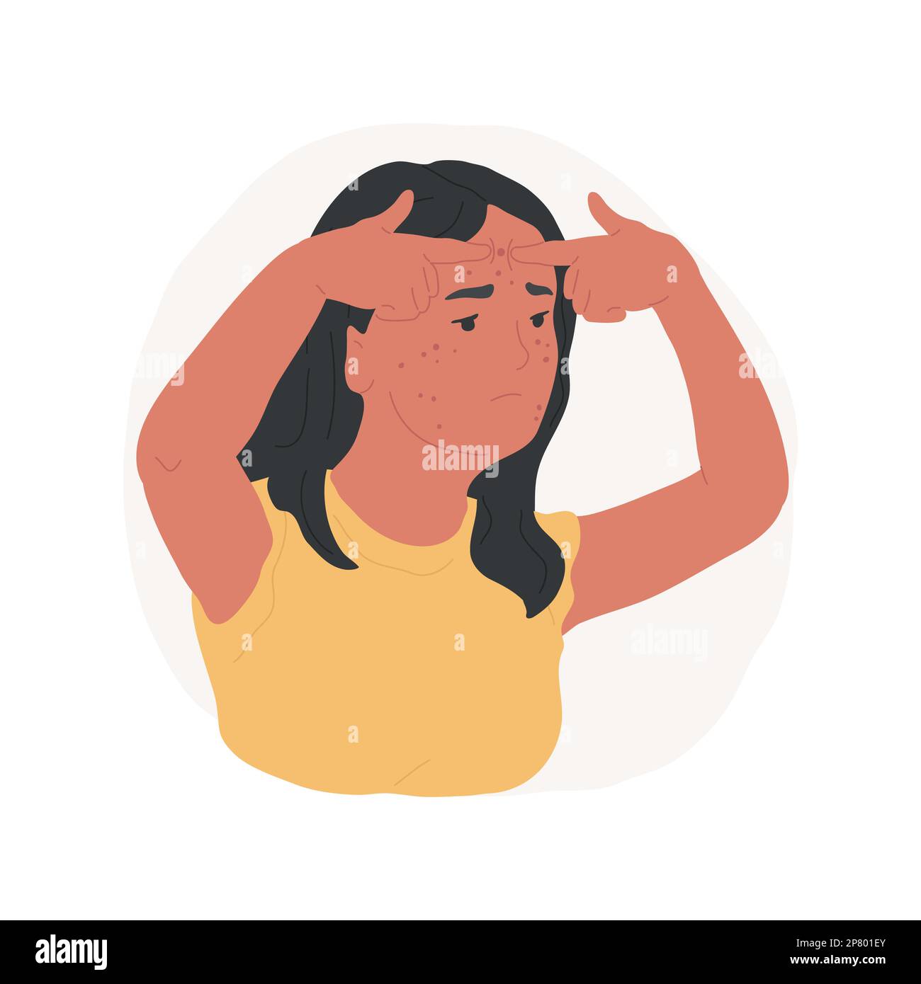 Teenage acne isolated cartoon vector illustration. Problem skin, sad girl  trying squeezing pimple on her forehead, beauty care, teenager fighting acne,  woman complexes vector cartoon Stock Vector Image & Art - Alamy