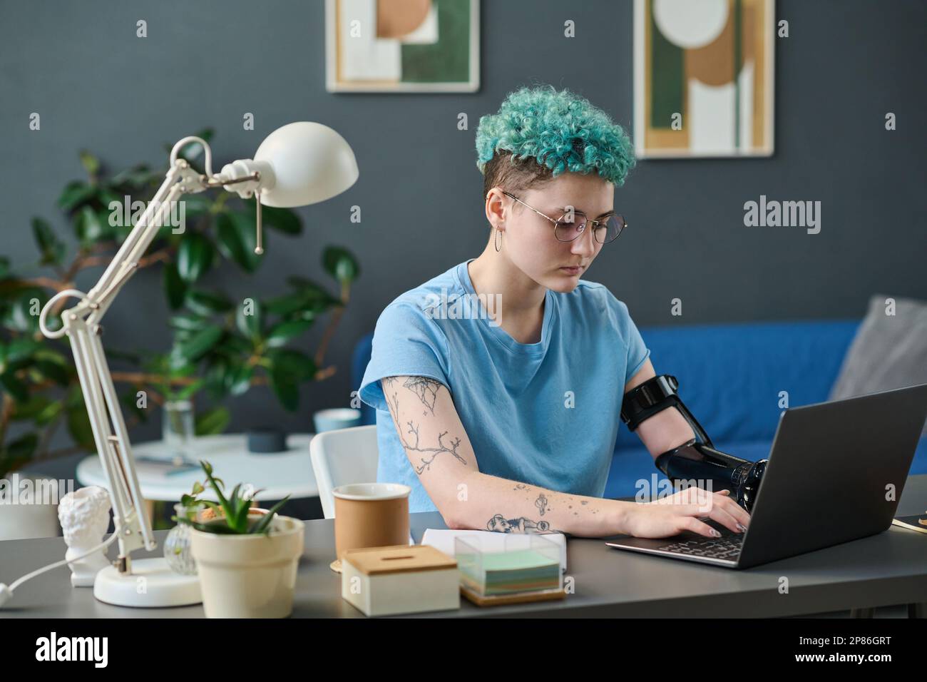 Young woman with prosthetic arm typing on laptop doing her online work at home Stock Photo