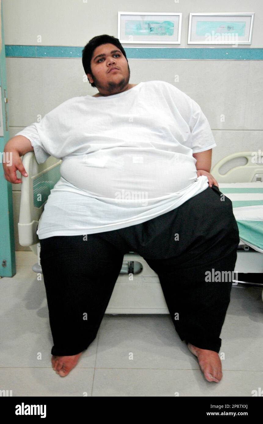 Dilkhush Patel 17 a student of Indian origin who now lives in Kenya and weighs 248.3 kilograms 547.4 pounds is seen after he underwent gastric bypass surgery at a hospital in Ahmadabad