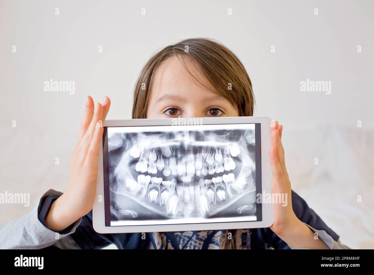Child, preteen boy, holding tablet with a picture of his xray teeth
