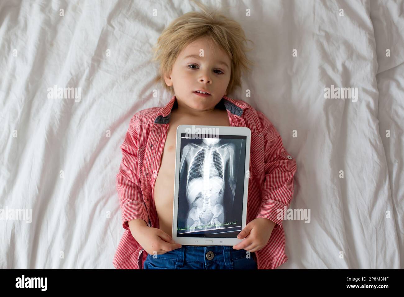 Toddler child, blond boy, holding xray picture on tablet of child body