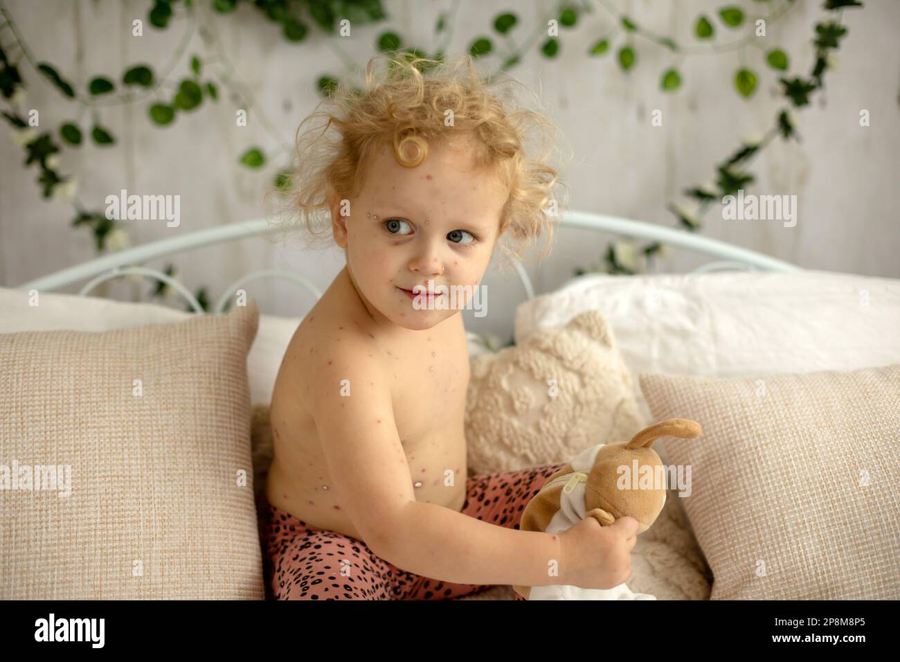 Little toddler girl with chickenpox in bed, playing at home, quarantine