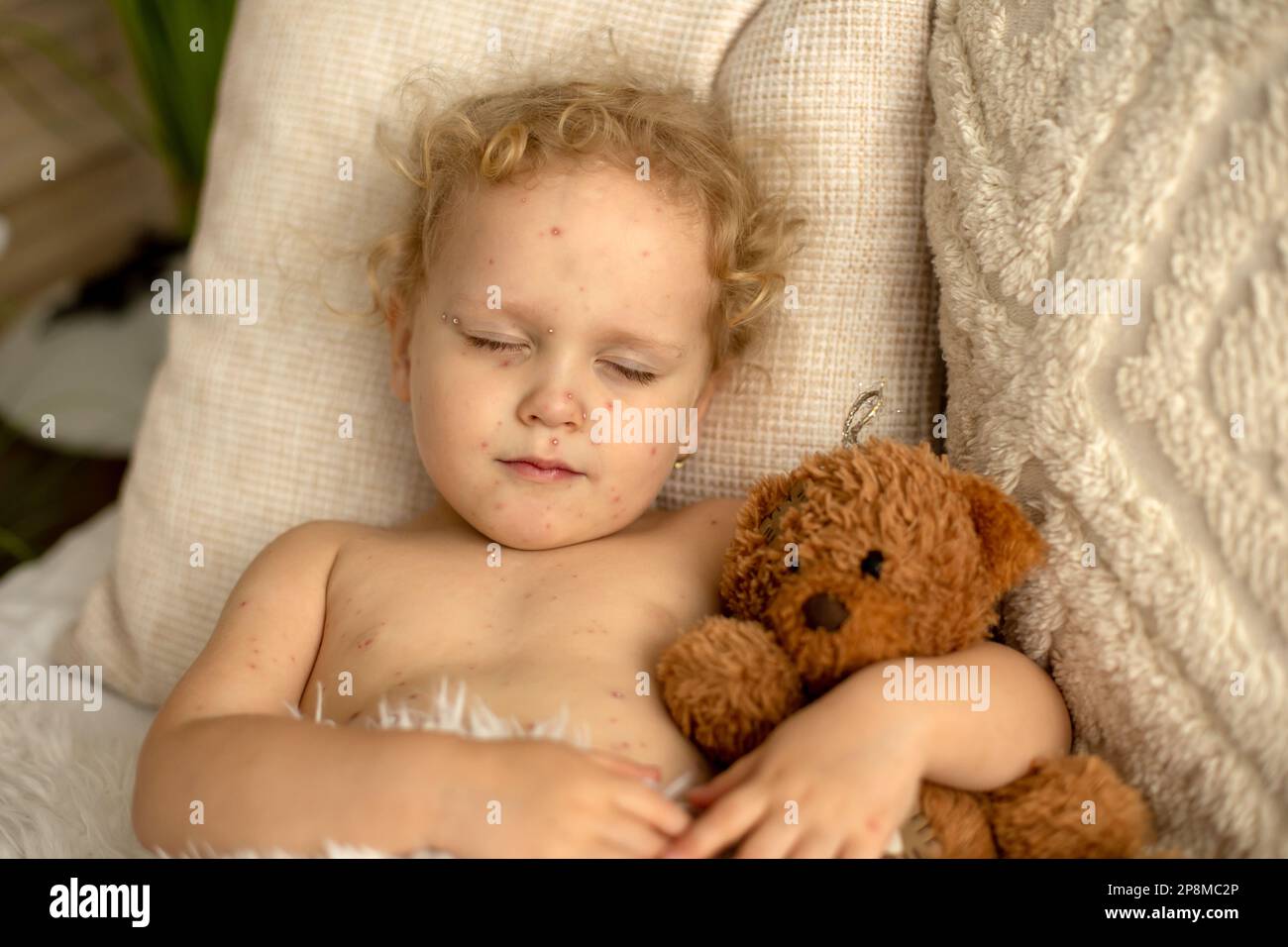 Little toddler girl with chickenpox in bed, playing at home, quarantine