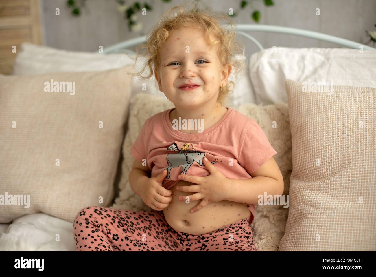 Little toddler girl with chickenpox in bed, playing at home, quarantine