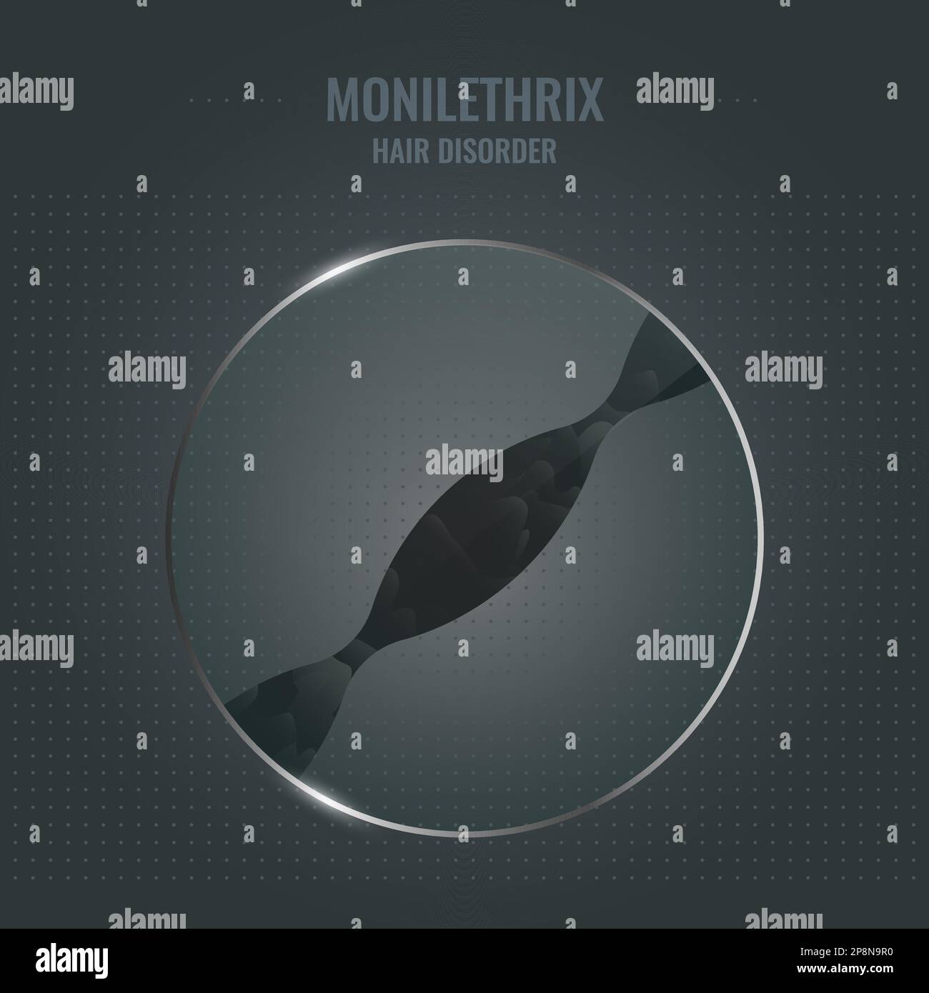 Monilethrix hair brittle disorder in close up Stock Vector Image & Art