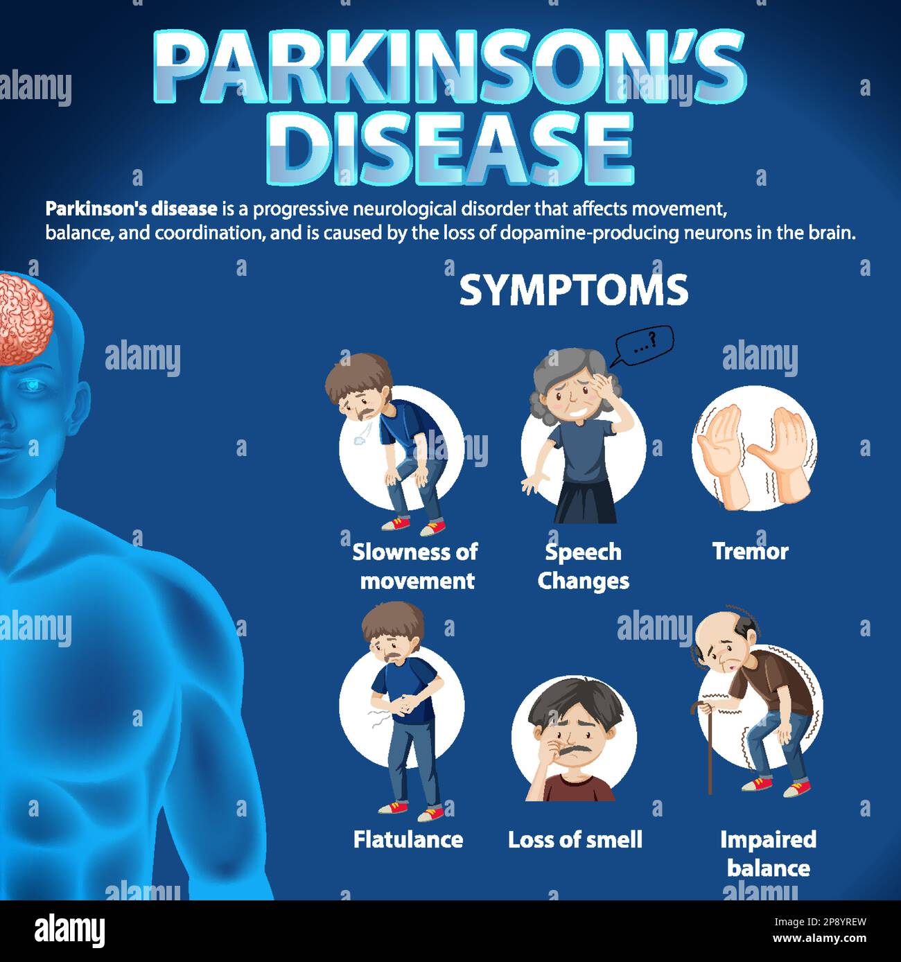 Informative poster of Parkinson disease illustration Stock Vector Image