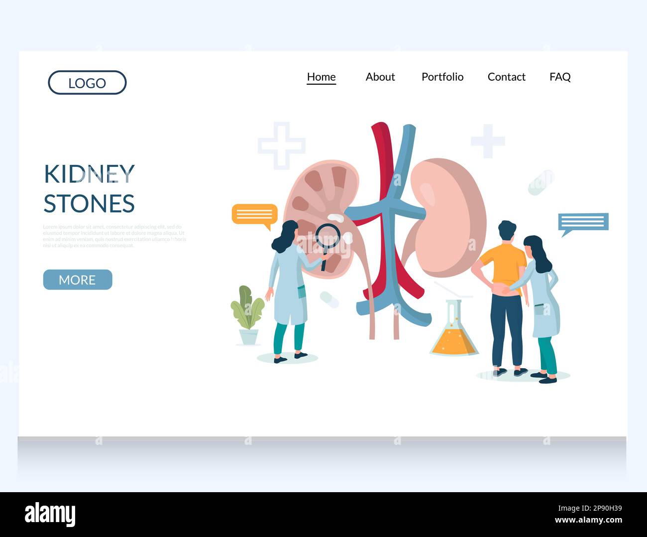 Kidney stones vector website landing page design template Stock Vector