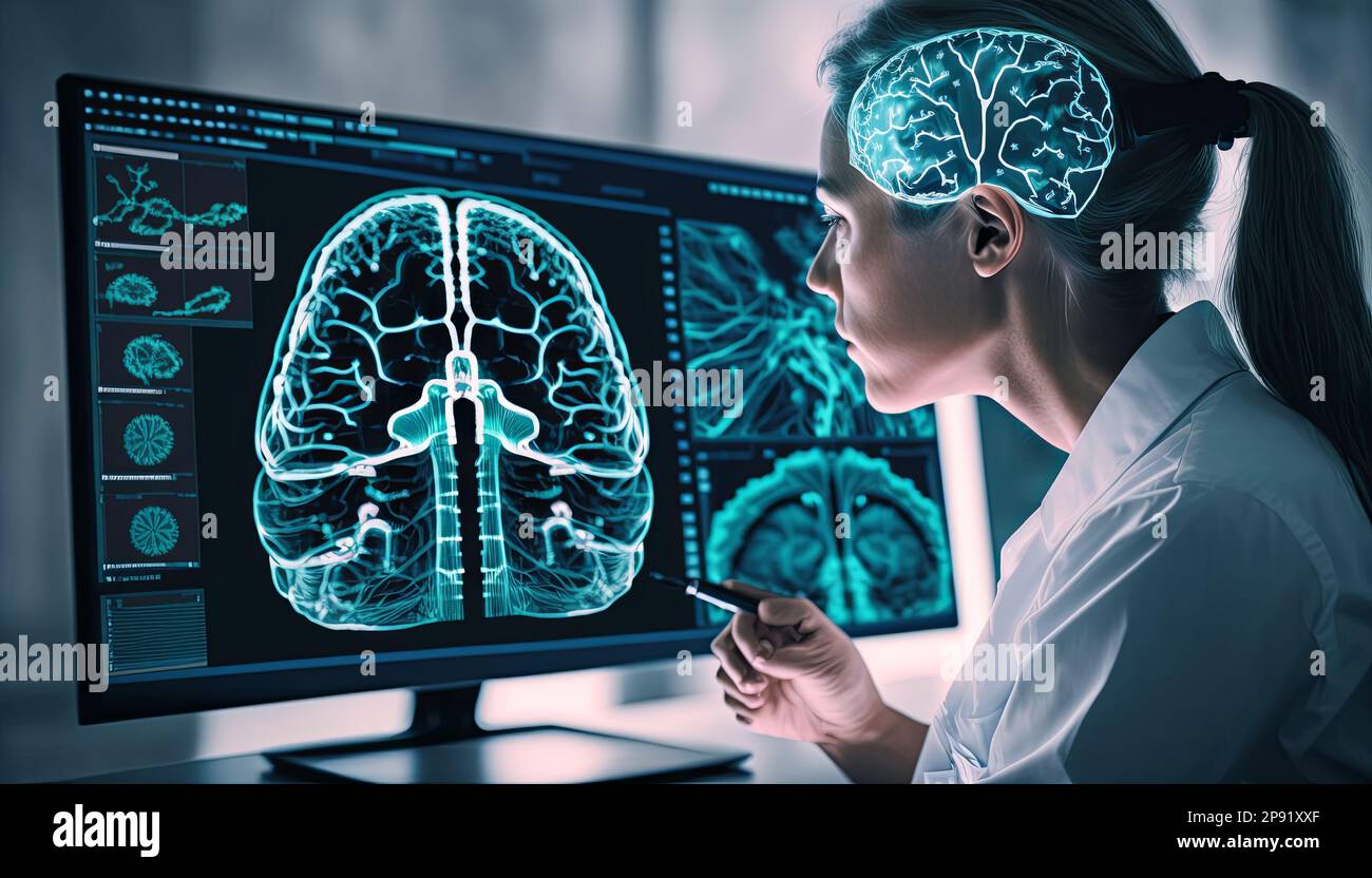 Alzheimer's brain scan image hi-res stock photography and images - Alamy