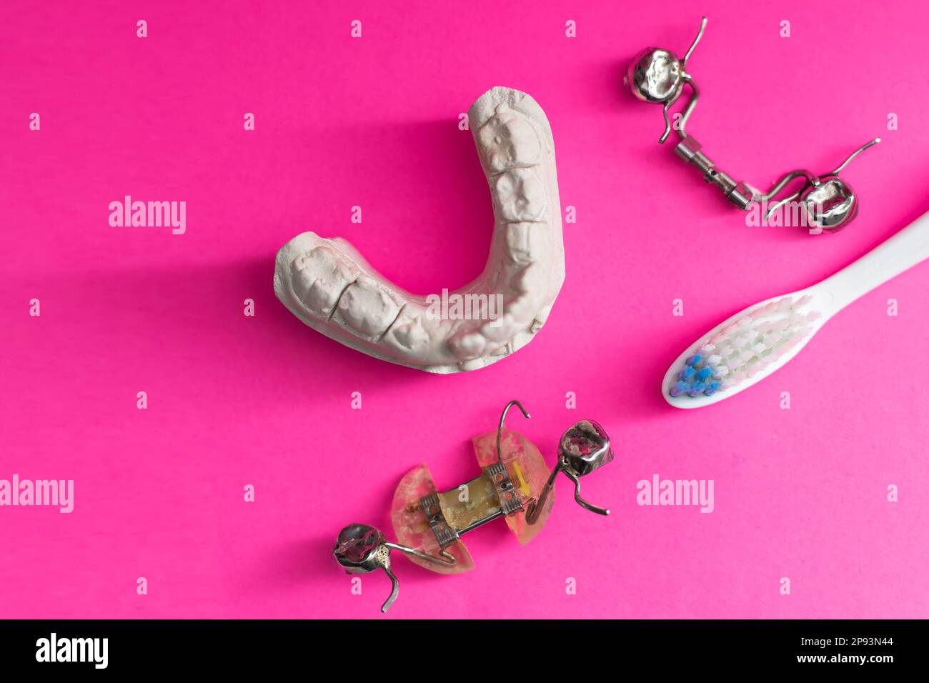 dental plate, plaster cast of child's jaw and toothbrush on blue
