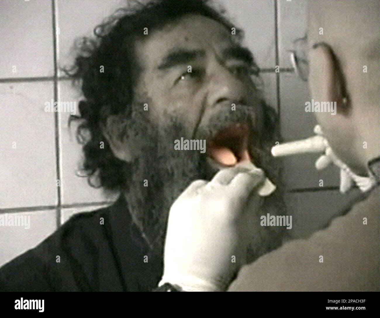 FILE** Captured former Iraqi leader Saddam Hussein undergoes medical  examinations in Baghdad in this Dec. 14, 2003 file photo,in this image from  television. (AP Photo/US Military via APTN-File Stock Photo