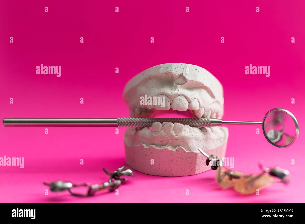 dental plates, dental plates for aligning teeth in a child Stock Photo Alamy