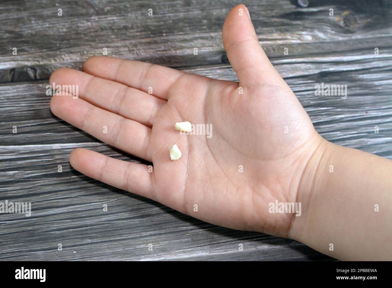 Deciduous primary baby temporary teeth, the first set of teeth in the