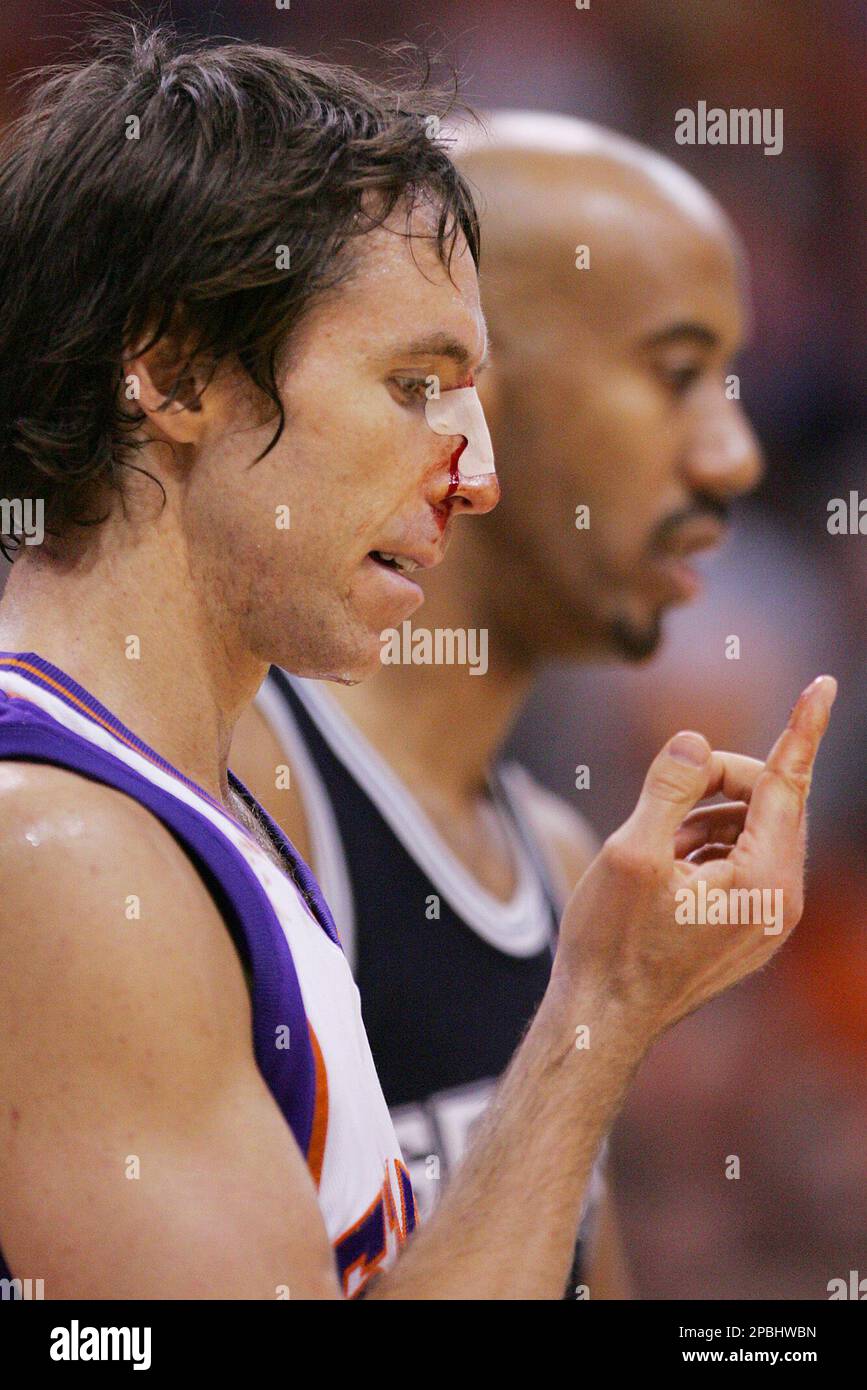 Phoenix Suns' Steve Nash, left, wipes blood from his cut on Phoenix Suns' Steve Nash, left, wipes blood from his cut on