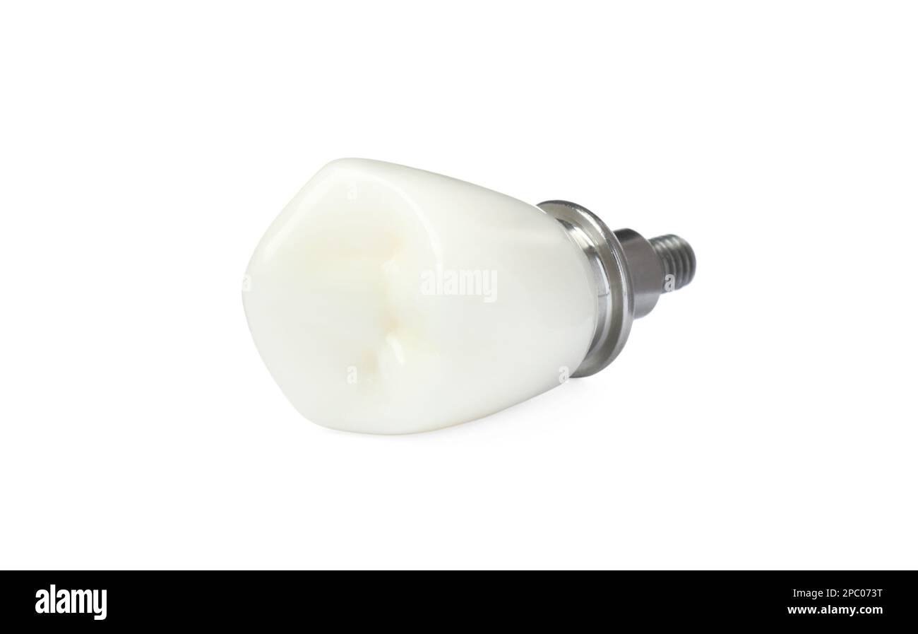 Crown of dental implant with abutment isolated on white Stock Photo Alamy