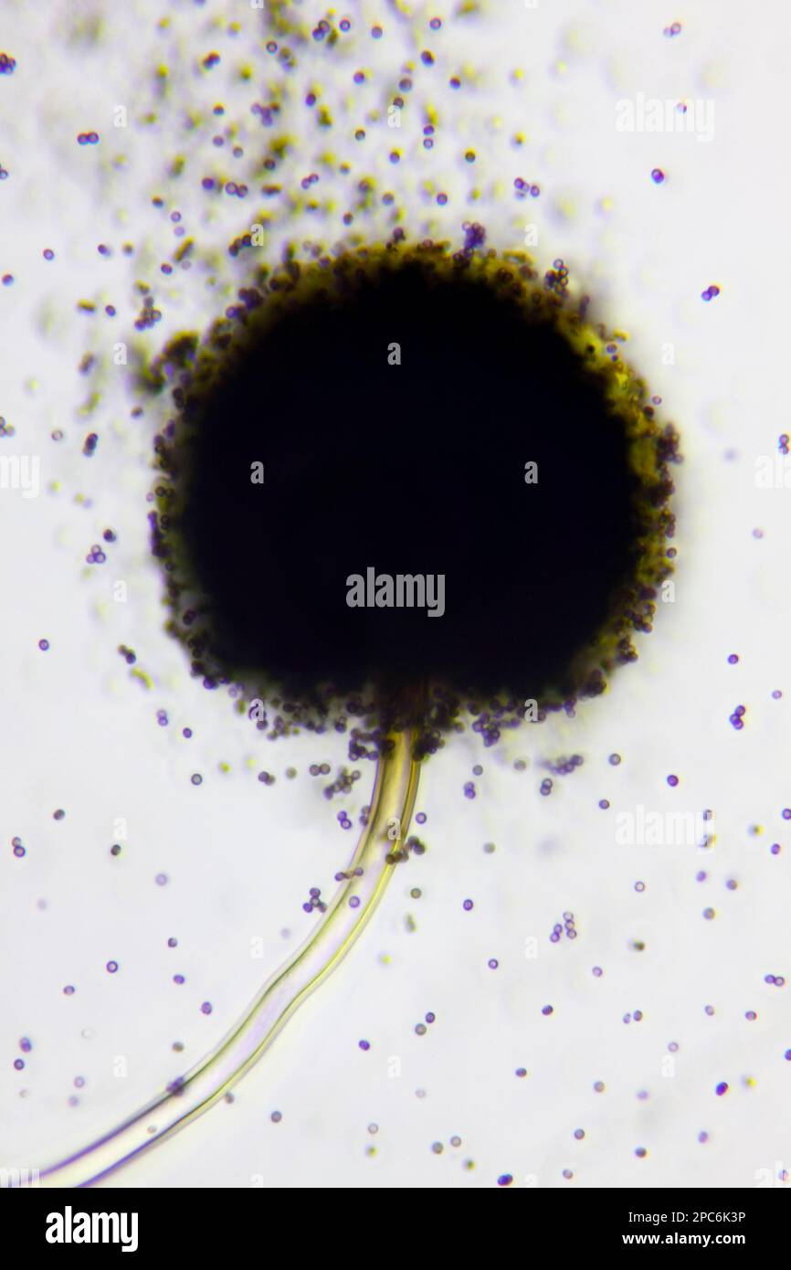 Microscopic view of a conidial head of Black mold (Aspergillus niger) with spores. Brightfield illumination. Stock Photo