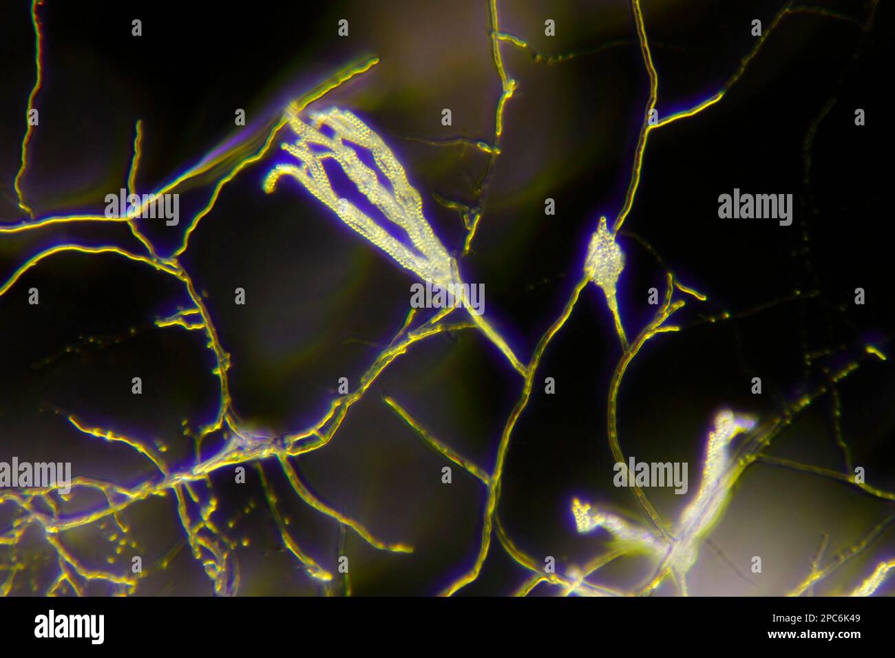 Microscopic view of a mold (Penicillium) and its spores on conidiophores. Darkfield illumination. Stock Photo