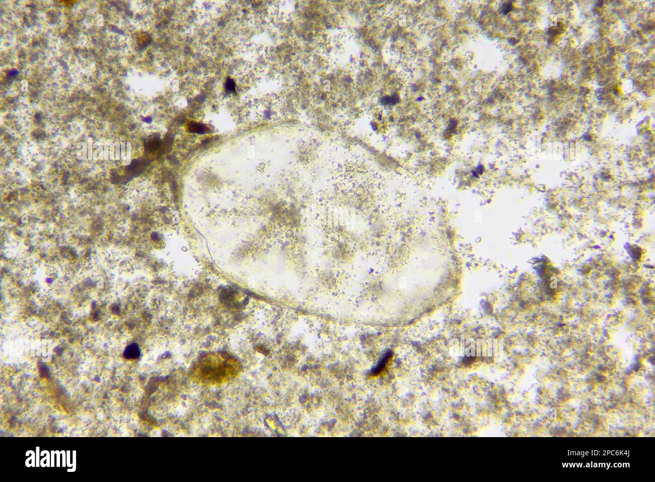 Microscopic view of Foraminifera test (shell) extracted from silurian limestone. Brightfield illumination. Stock Photo