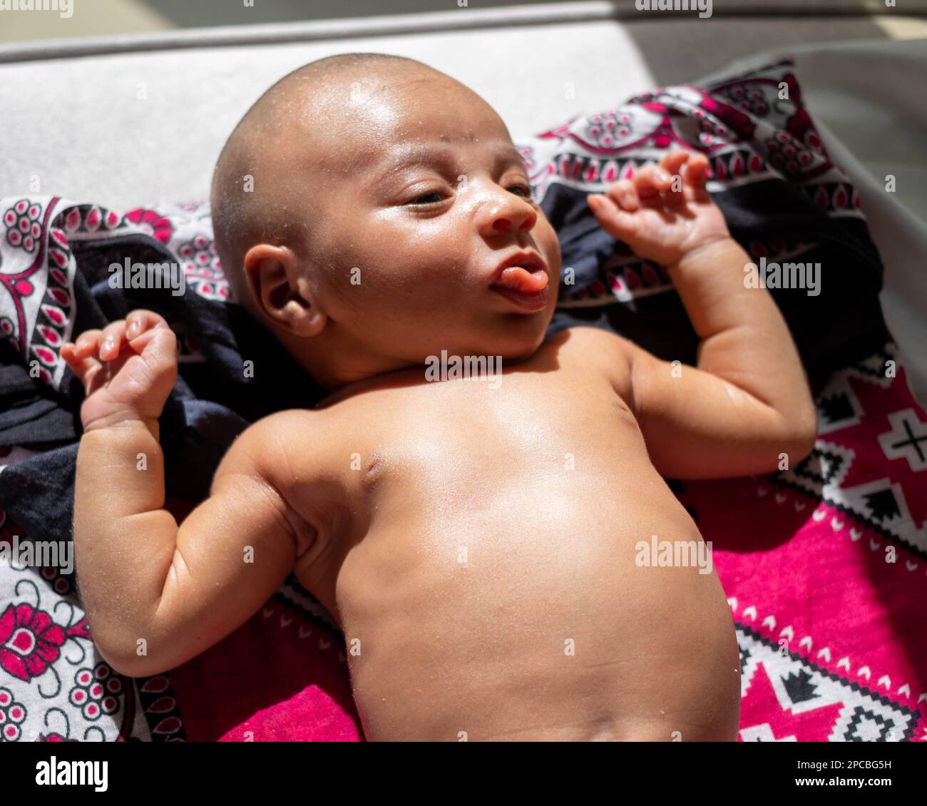 Natural Phototherapy for Newborn.A newborn baby girl laying at a direct sunlight to help reduce her newborn jaundice Stock Photo