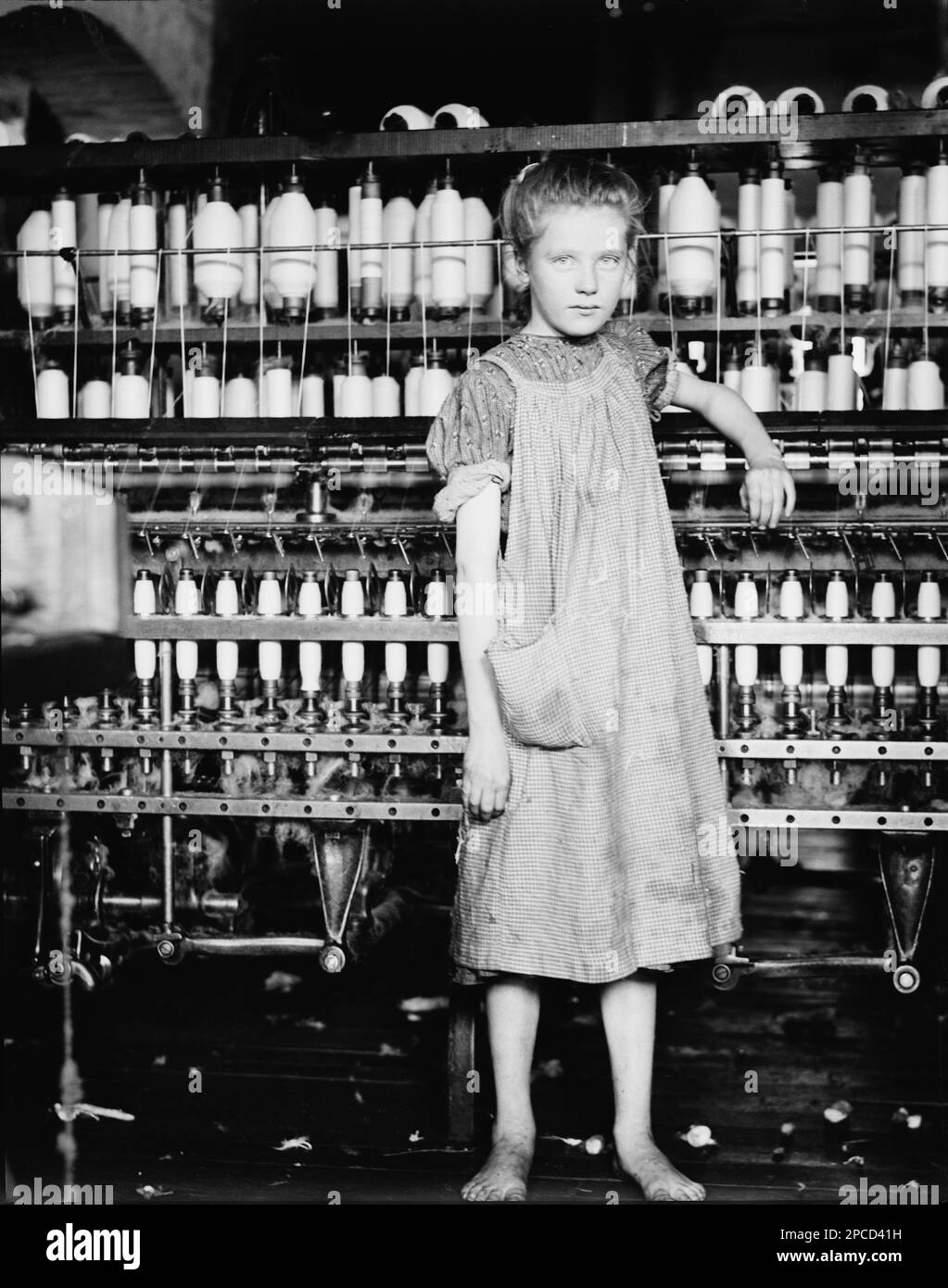1910 february , North Pownal , Vermont , USA :  Addie Card , 12 years.  Spinner in North Pownal  Cotton Mill. Vt.  Location: North Pownal , Vermont .  Photo taken by celebrated american photographer and sociologist LEWIS HINE   ( 1874 - 1940 ) for the Children's Bureau of US Govern . Hine used his camera as a tool for social reform.   - BAMBINI -  BAMBINA - LAVORATORI - BAMBINO IN FABBRICA - CHILDREN WORKERS - FACTORY - CHILDHOOD - INFANZIA - LAVORO MINORILE - LAVORO - WORK - LAVORATORE - WORKER - OPERAIO -  CLASSE OPERAIA LAVORATRICE - WORKING CLASS - OPERAI - LAVORATORI - LAVORO - FILATOIO - Stock Photo