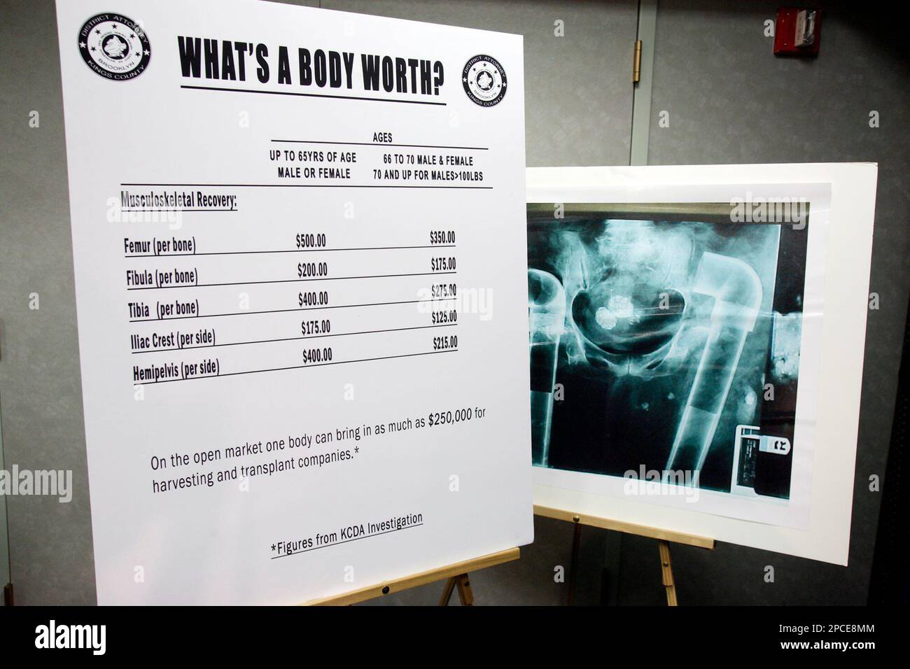 The value of human body parts and an xray showing human body parts