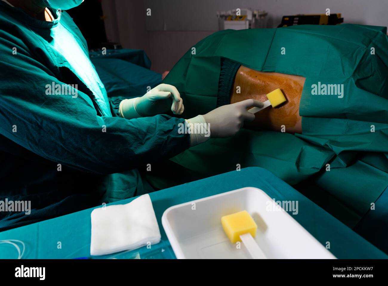 Doctor or surgeon apply betadine to the patient for anesthesia