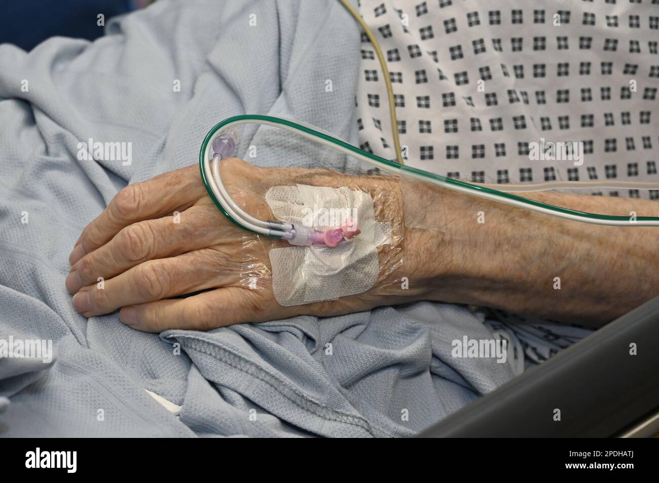 Iv Line In Hand Intravenous lines in patient’s hand Stock Photo - Alamy