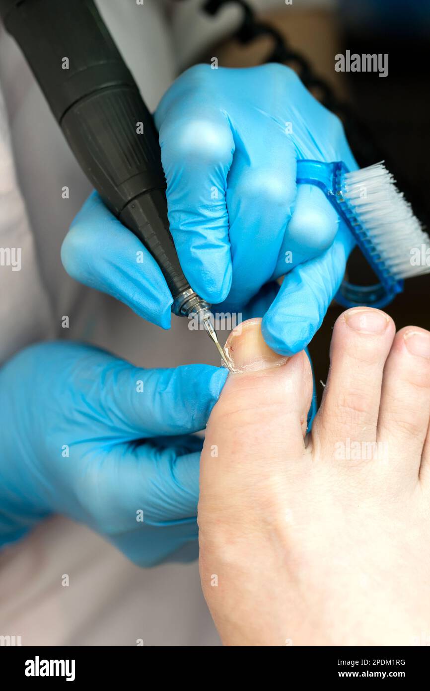 Hardware pedicure procedure closeup. Сhiropodist master processes toes