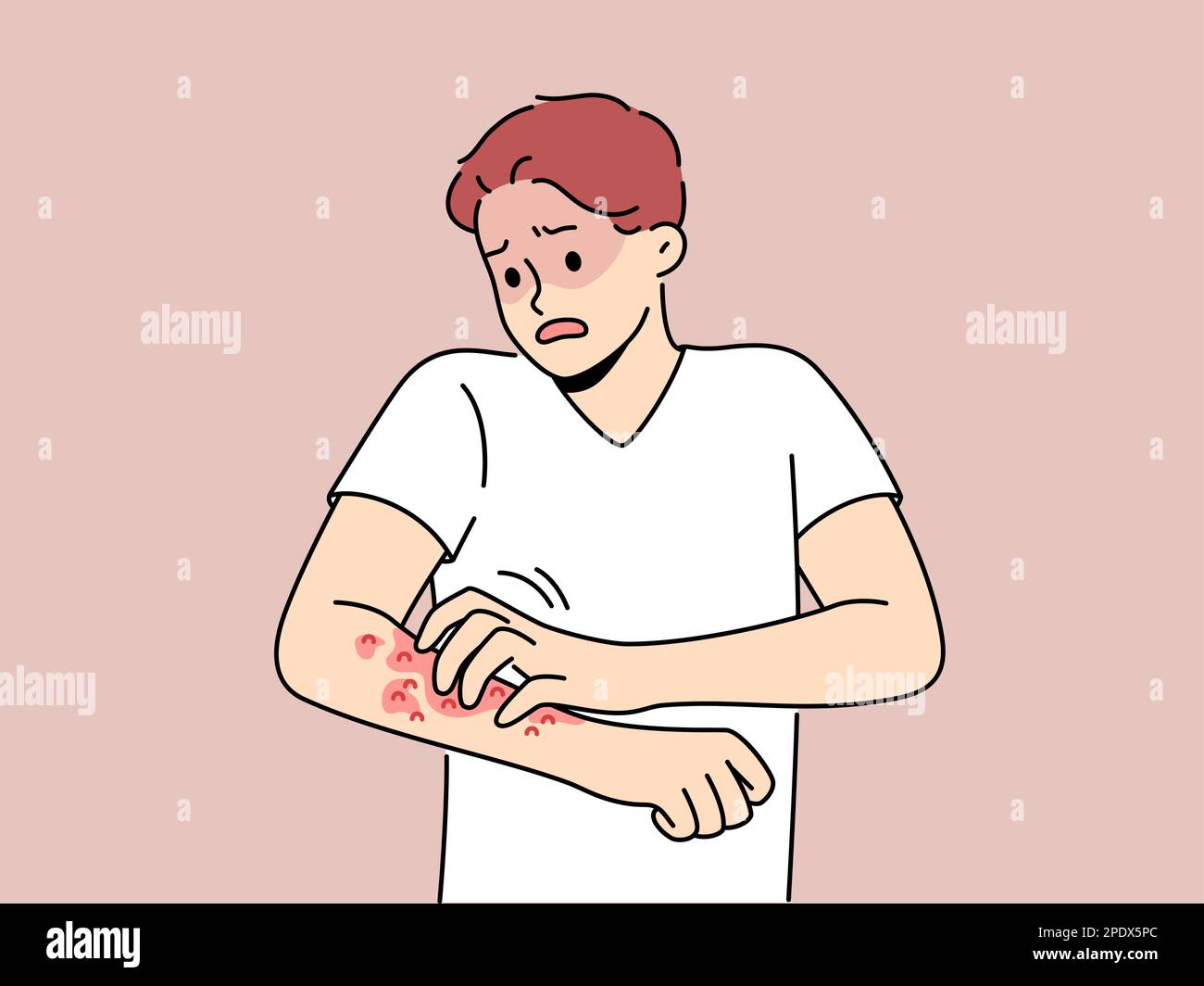 Unhealthy man scratch red pimples on arm suffer from allergy or dermatitis. Stressed unwell guy suffer from itchiness and redness. Healthcare. Vector illustration.  Stock Vector