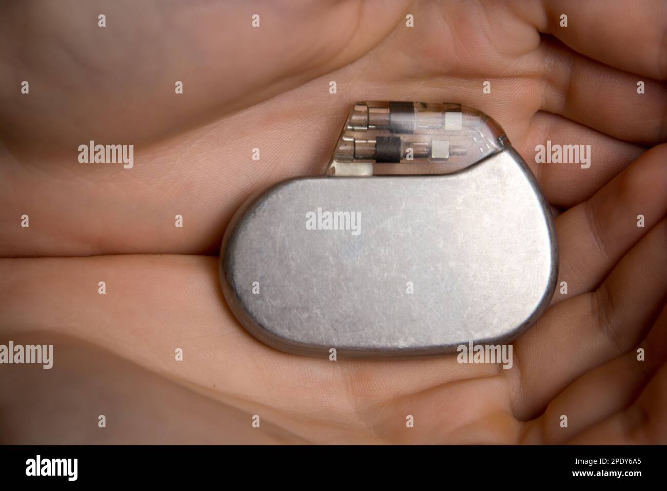 medical pacemaker hold in hand Stock Photo - Alamy