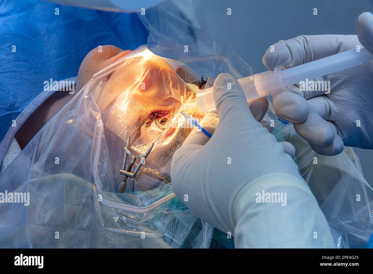 Laser vision correction. A patient and team of surgeons in the ...