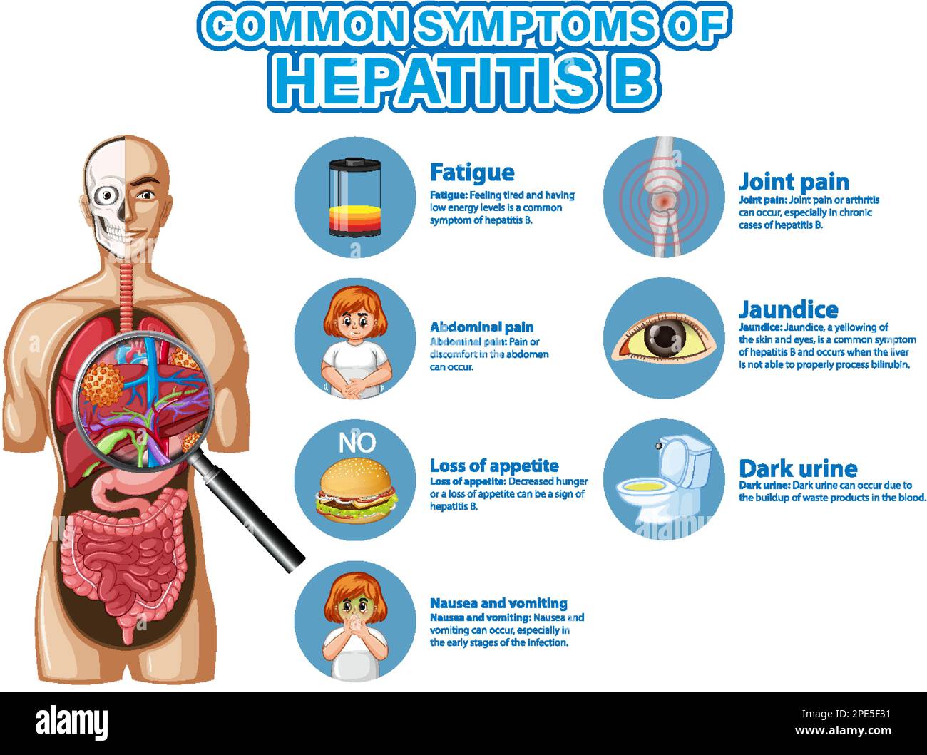 Hepatitis B Symptoms And Signs