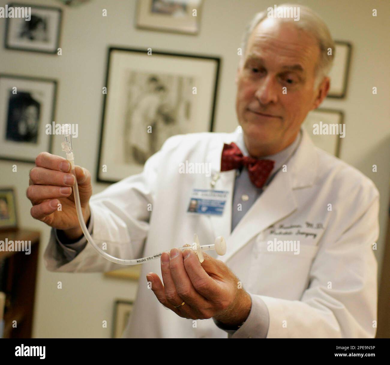 Michael W.L. Gauderer, M.D., FACS, FAAP, shows a Gastrostomy Tube