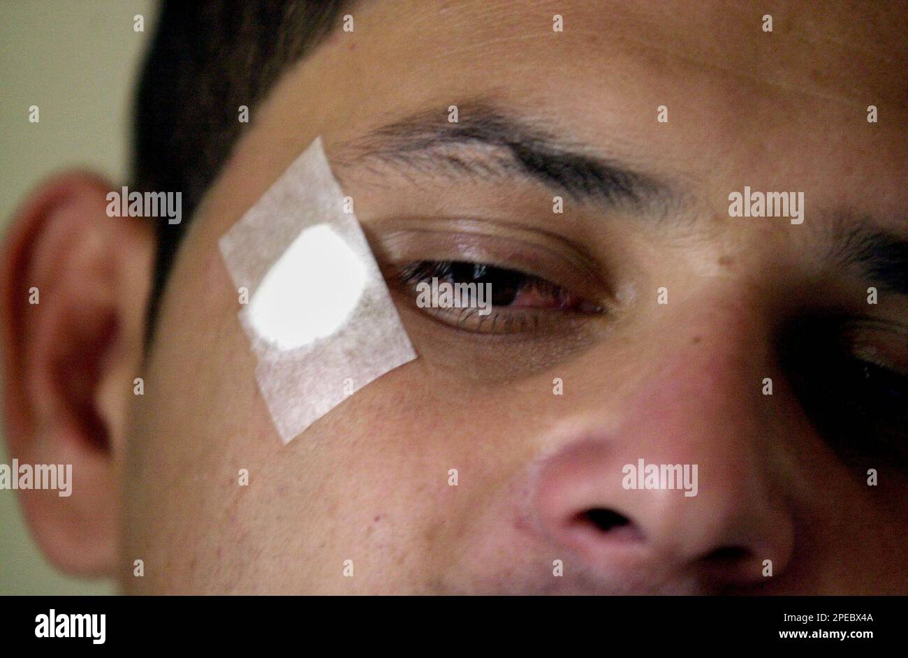 Gang member Fredy Monterrosa, 26 , shows a bandage in his face in the area  where he once had a tear shaped tatto after he removed it with infrared  rays at the \, image size:1300x942