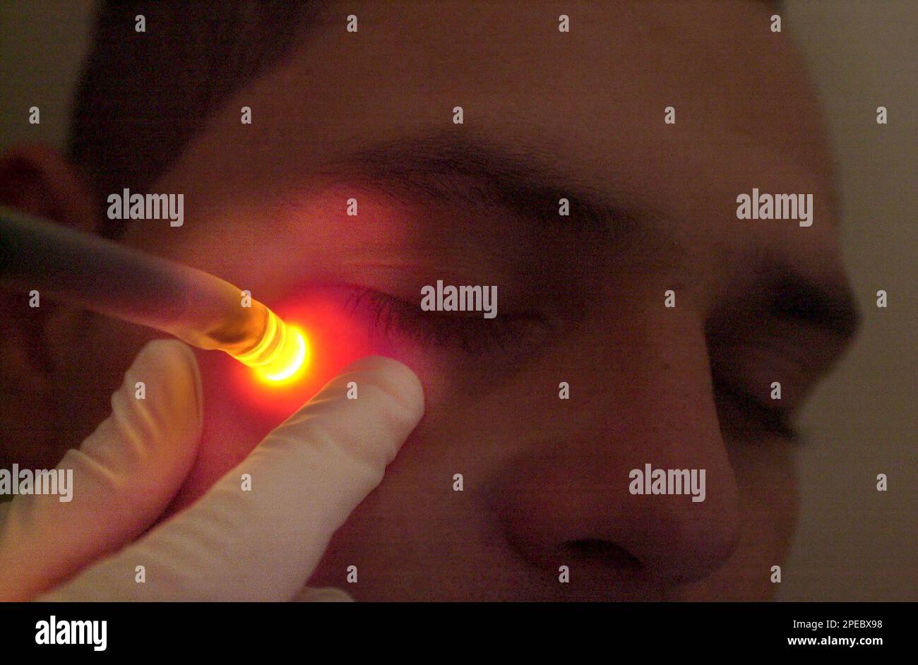 Gang member Fredy Monterrosa, 26, gets a tear shaped tattoo removed from  his face with laser at the Community Health Center \, image size:1300x942