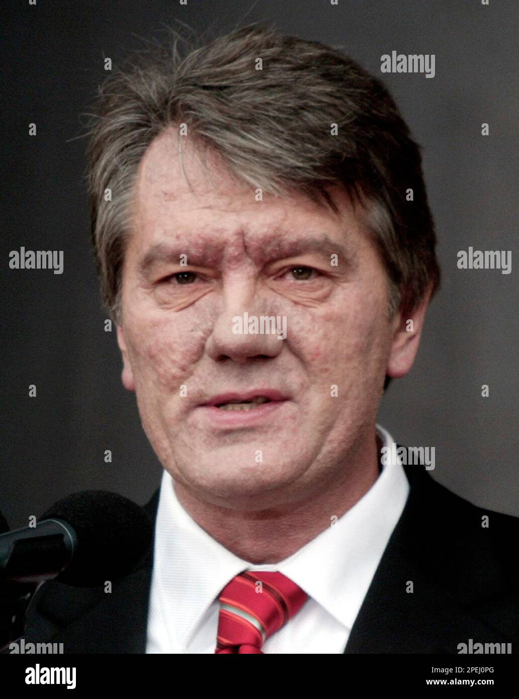 What Happened To Viktor Yushchenko Face