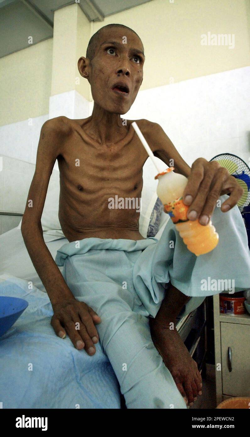 **THIRD OF SIX STANDALONE PHOTOS ON AIDS STORY**An AIDS patient sits on