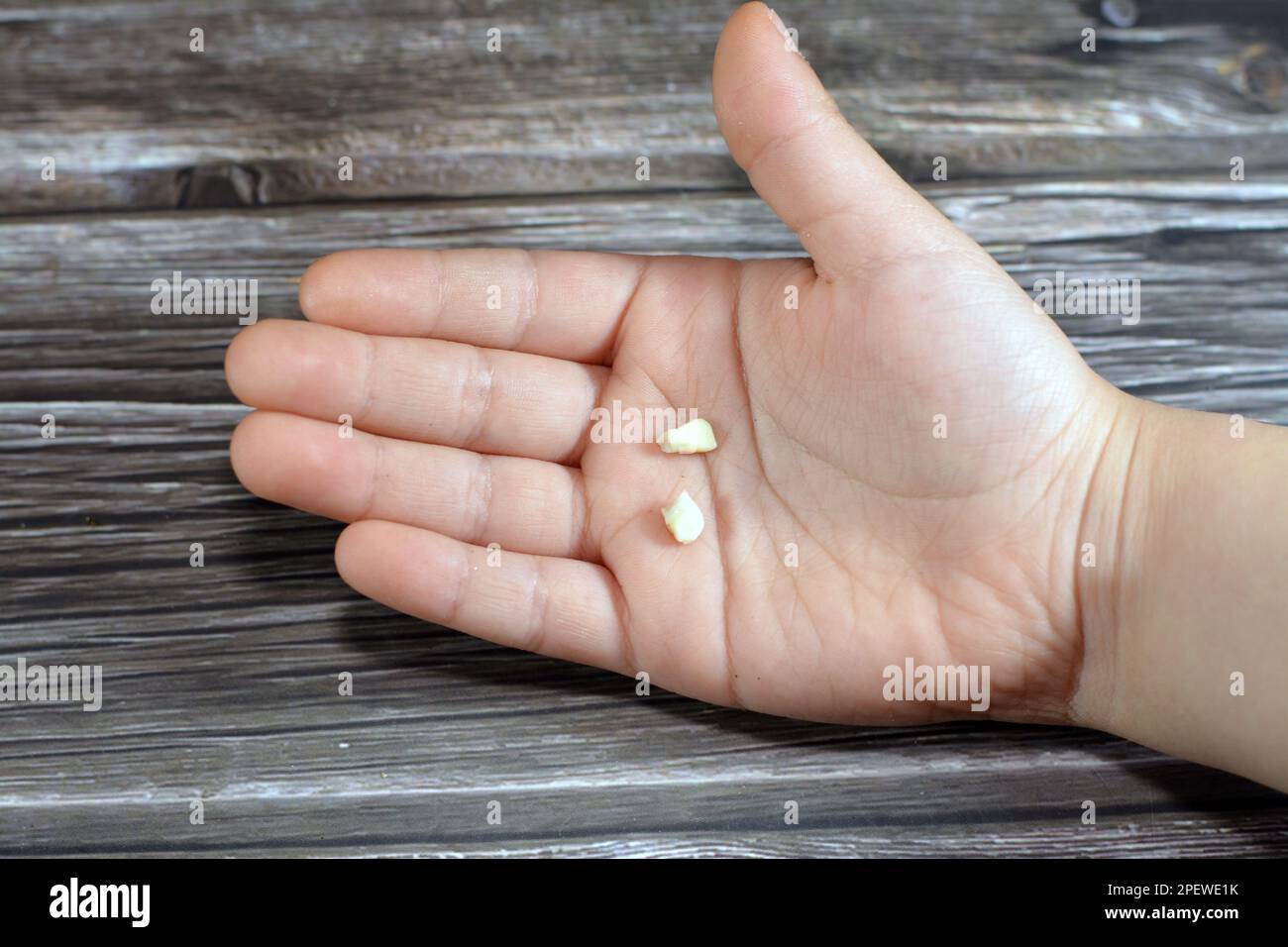 Deciduous primary baby temporary teeth, the first set of teeth in the