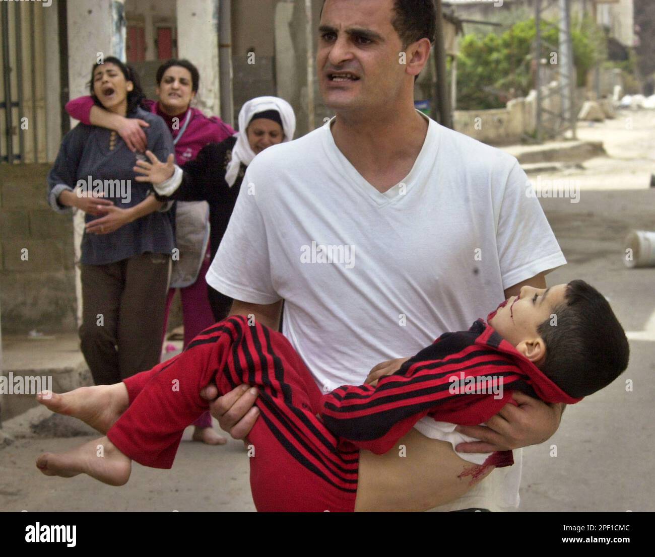 Samer Walweel carries his 7-year old nephew Khaled as the mother of the ...