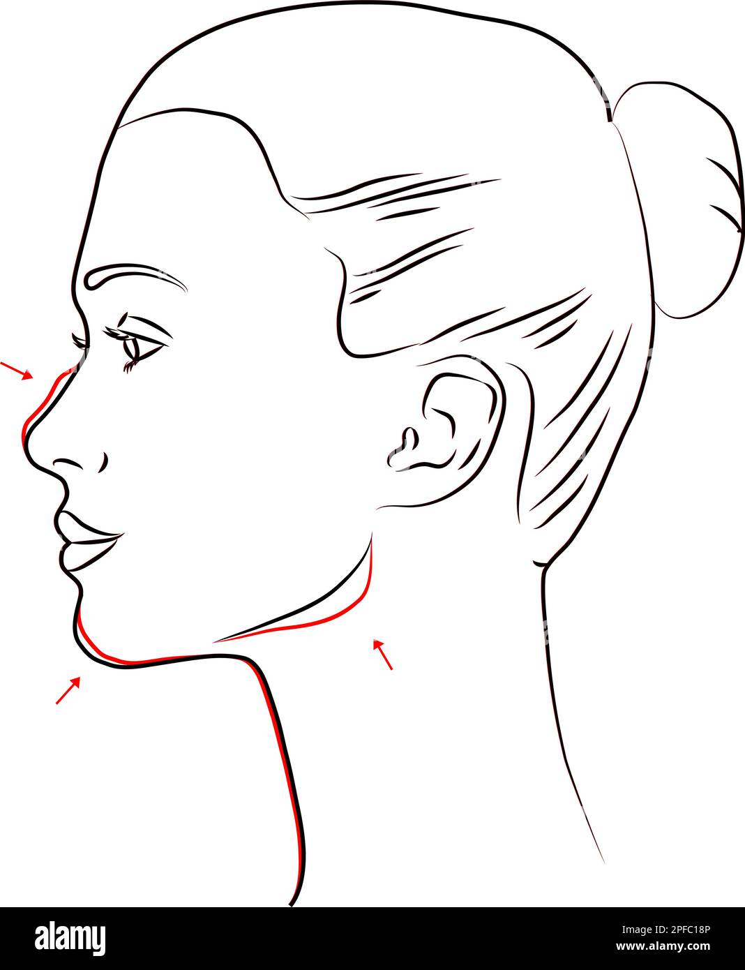 aesthetic medicine before and after of a woman's profile. Line drawing vector illustration Stock Vector