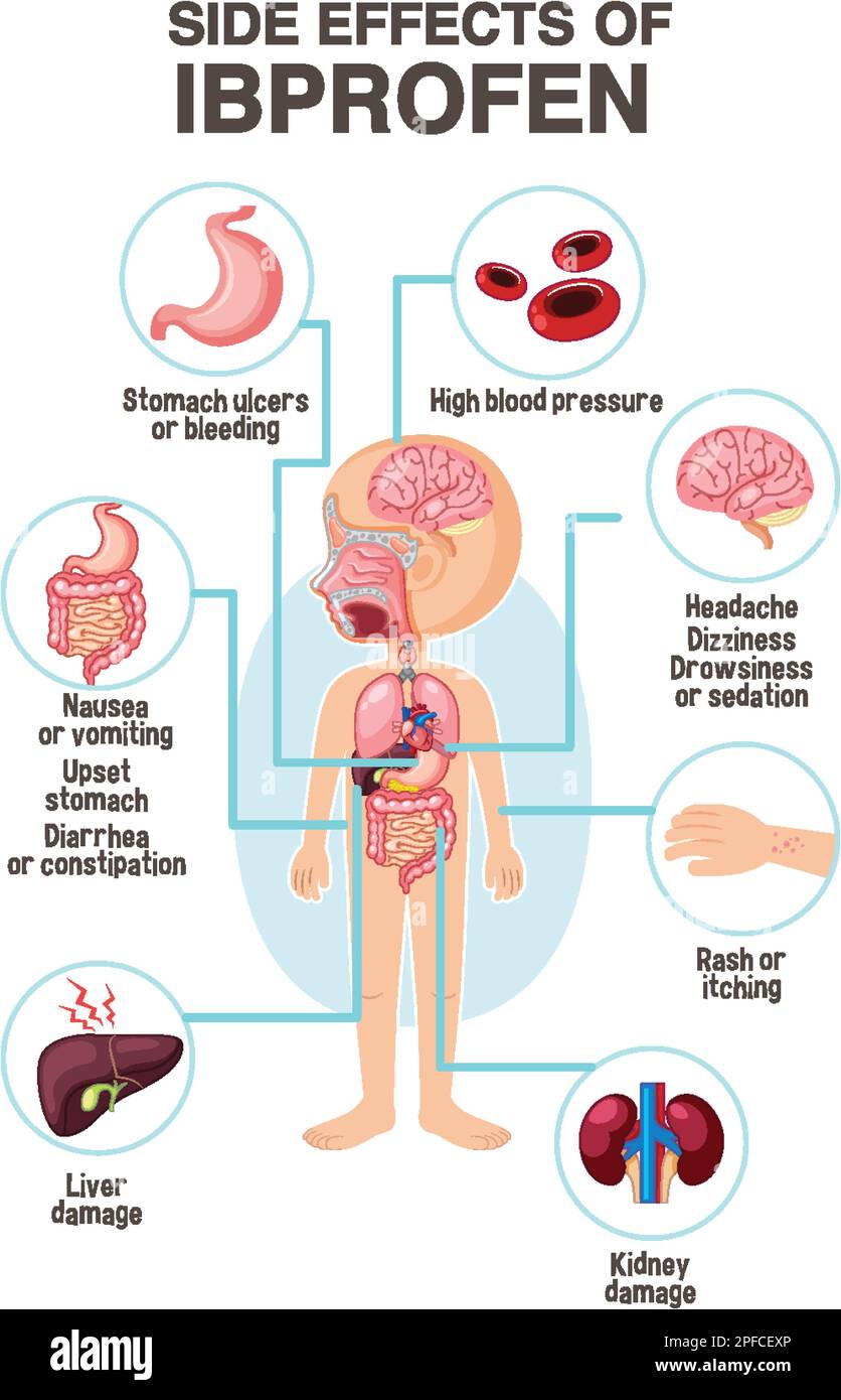 Human anatomy diagram cartoon style of ibuprofen side effects