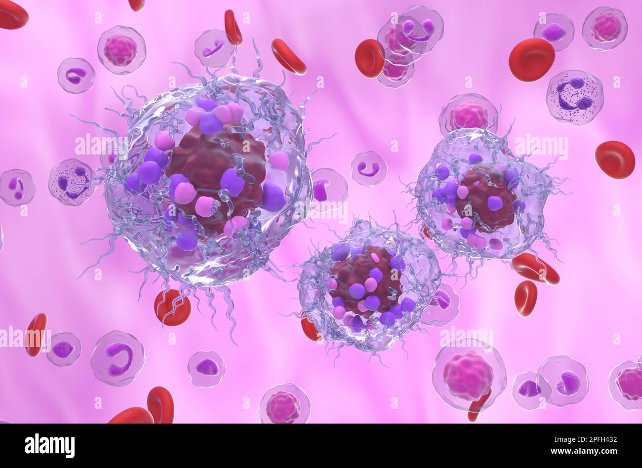 Metastatic neuroendocrine tumor cells in the blood flow - 3d illustration isometric view Stock Photo