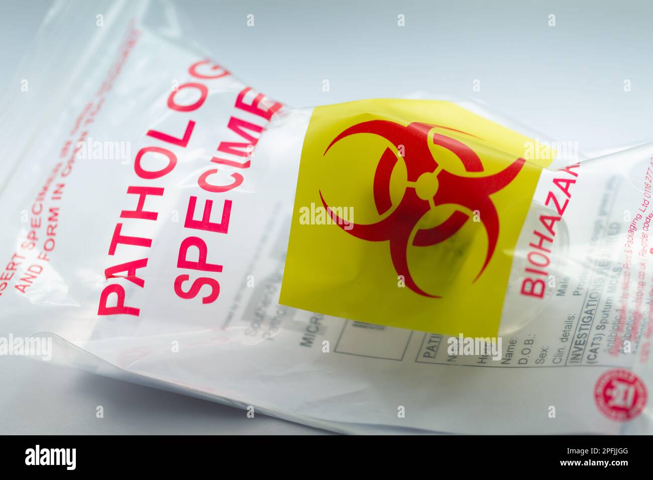 Close-up of  a pathology lab specimen bag marked Biohazard. Stock Photo