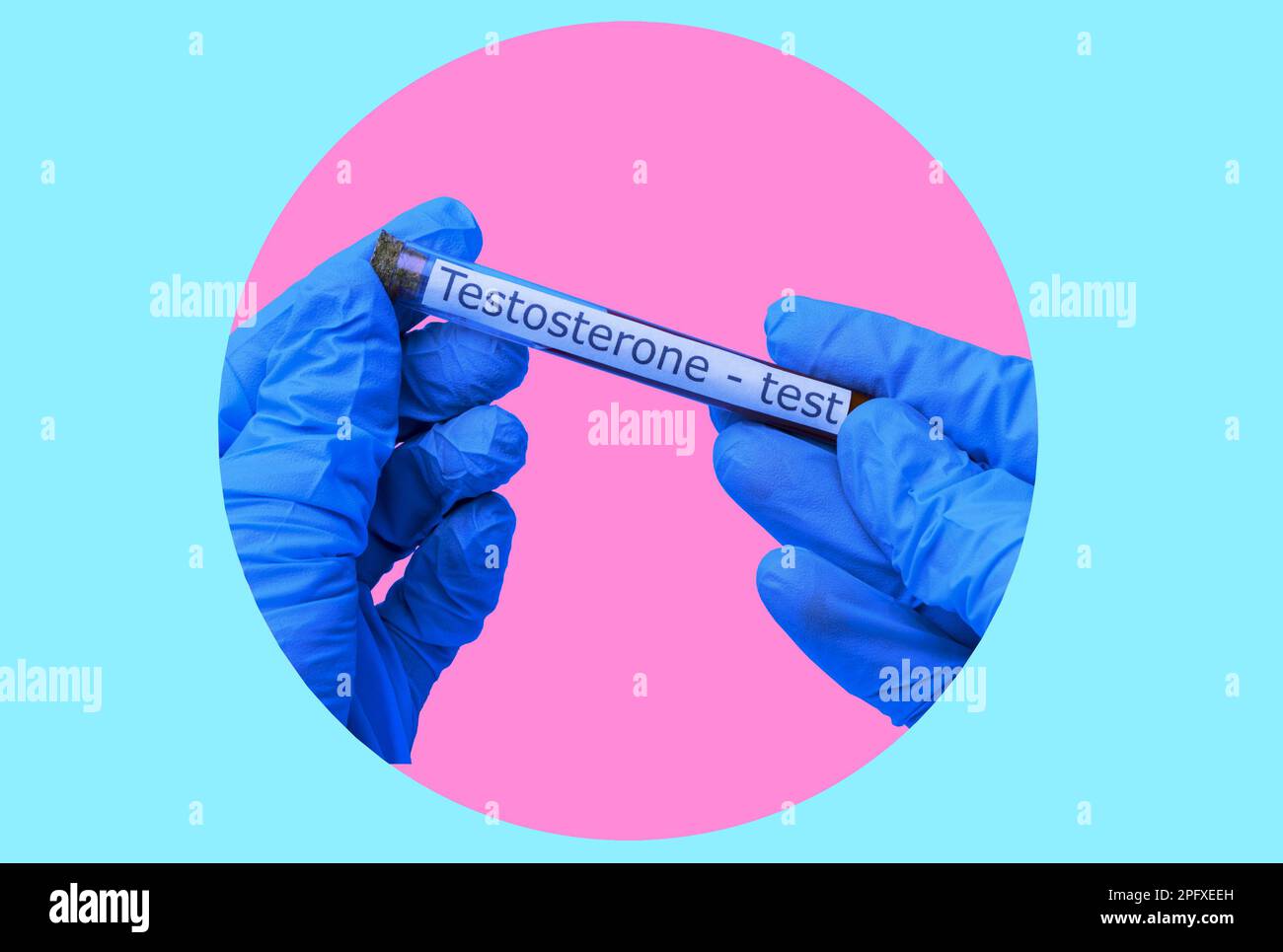 Art collage, gloved hands with a blood test tube for a testosterone
