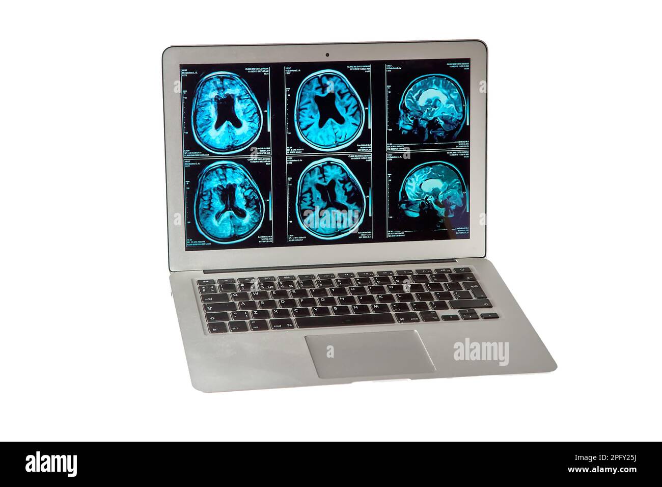resonance imaging of the human brain on a computer screen, for