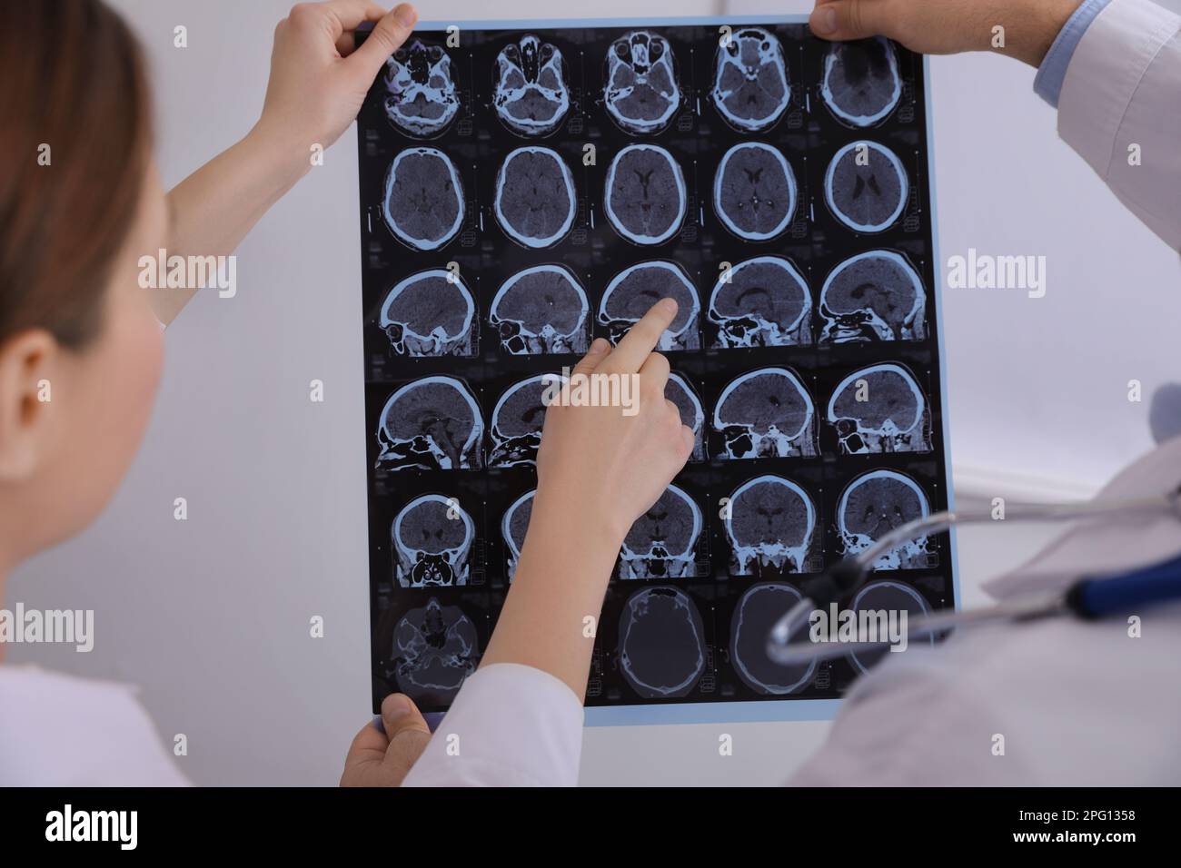 Doctors examining MRI images of patient with multiple sclerosis in clinic, closeup Stock Photo