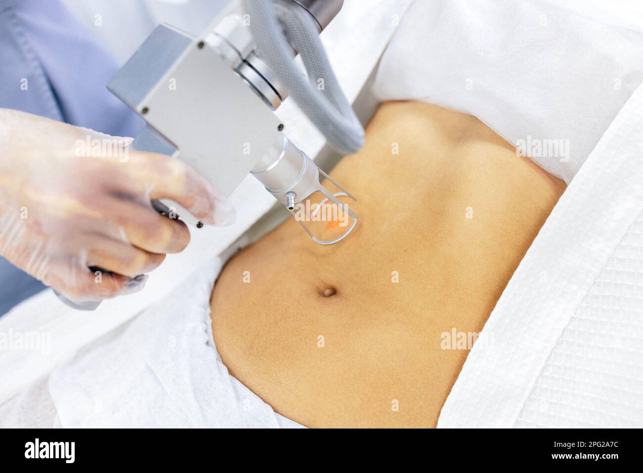 Removing scars with laser. Extreme close up of hand of doctor or cosmetologist in transparent glove, part of apparatus, red laser beam and lower abdom Stock Photo